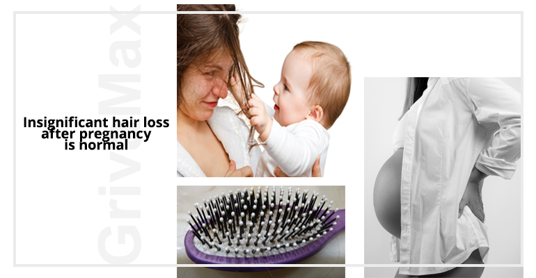 Hair loss after pregnancy