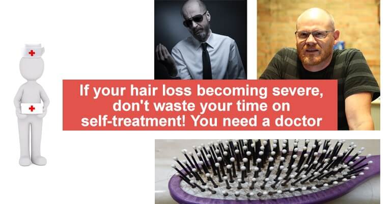 hair loss doctor