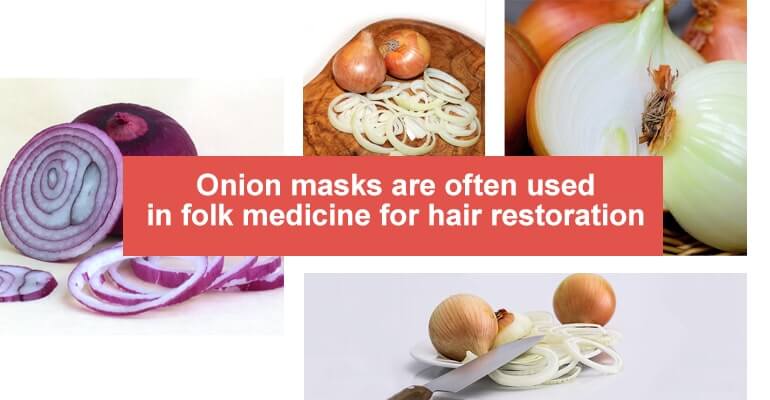 Onion