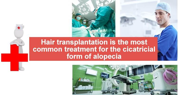 Hair transplantation