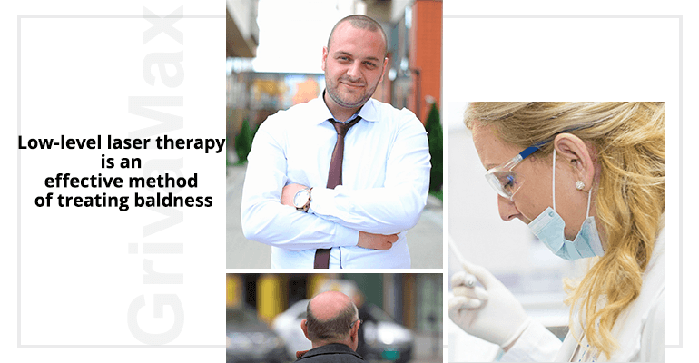 Low-level laser therapy is an effective method of treating baldness